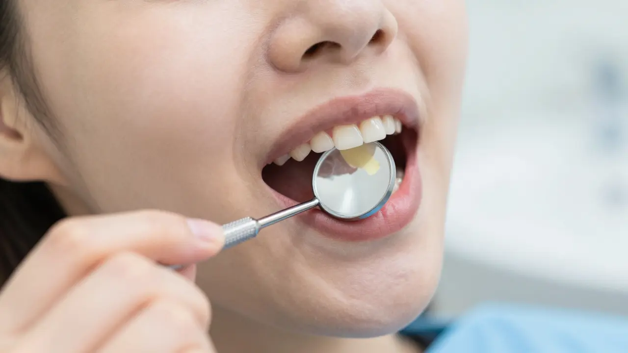 Dentální zrcátko: Jak ho používat pro kontrolu zubního plaku