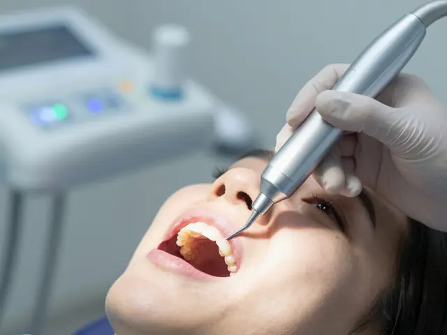 Jak odstranit zubní kámen pod dásní bez bolesti - Úplný návod