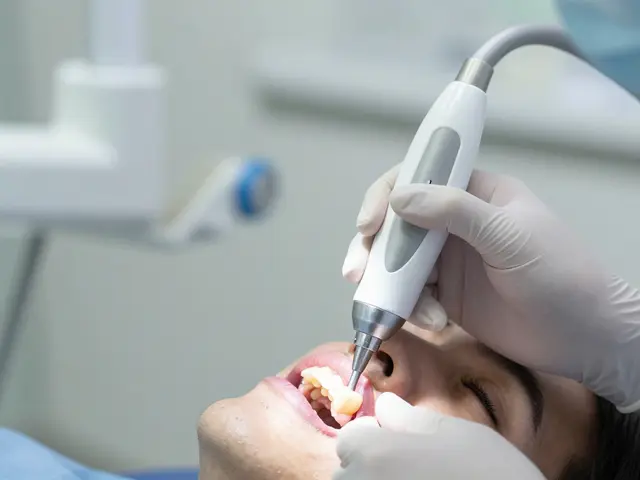 Jak odstranit zubní kámen pod dásní: praktický návod