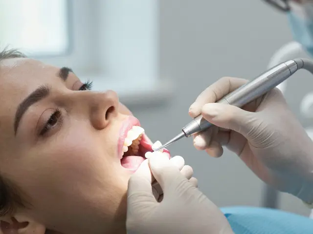 Kompozitní fazety cena: Co zahrnuje cena a jak se liší od jiných možností?