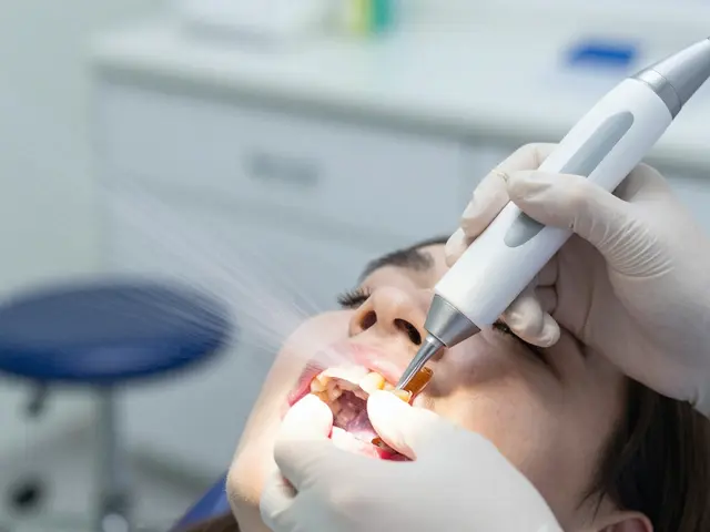 Odstranění zubního kamene: Jak dosáhnout bílých a zdravých zubů