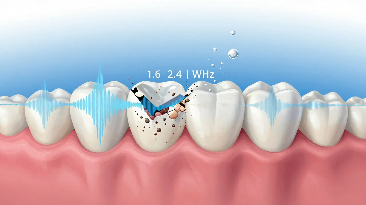 Zubní kámen a plak se rozpadají pod účinkem ultrazvukových vln, zuby jsou čisté a zdravé.