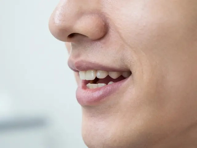 Jak poznat predkus a jak ho vyřešit pomocí keramických faset