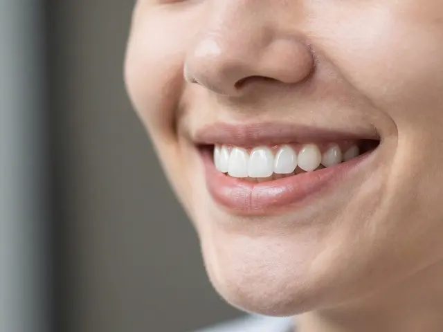 Veneers zuby: Jak se vyhnout komplikacím a zajistit dlouhou životnost